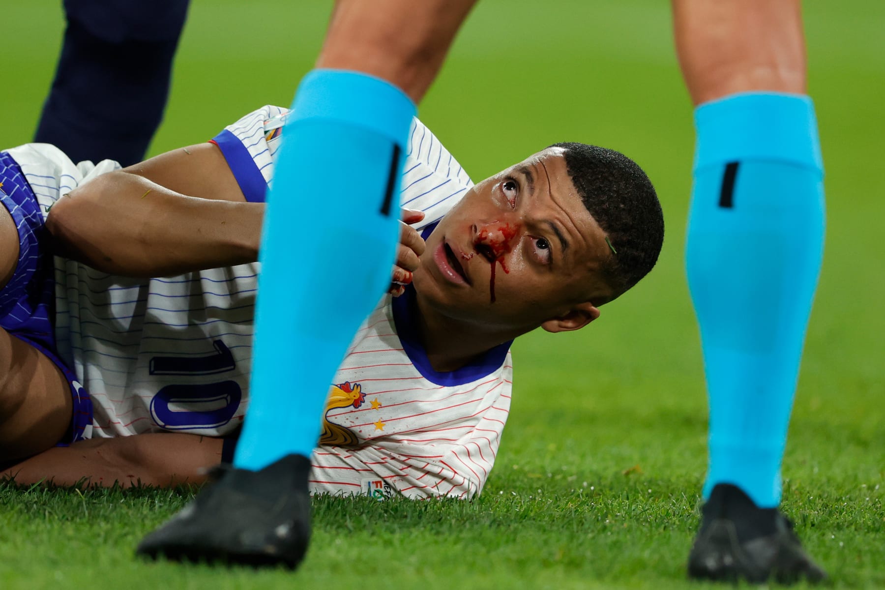 Mbappe thyen hundën, s'operohet menjëherë pritet të luajë me maskë - Dukagjini