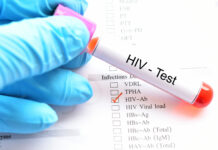 10 raste të reja me HIV në muajt e fundit, 2 viktima e 2 në spital, rritet testimi vullnetar
